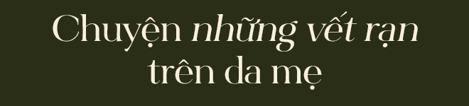 Vết nứt của đá trên bụng mẹ: Nỗi đau xé toạc thanh xuân nhưng là dấu ấn tuyệt đẹp của hành trình trưởng thành - Ảnh 14.