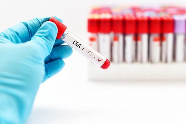 chiso-cea-1592012296180.jpg